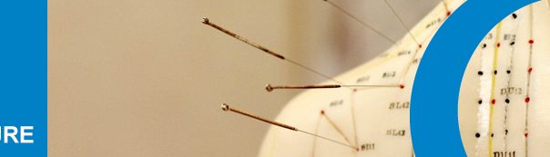 Acupuncture
