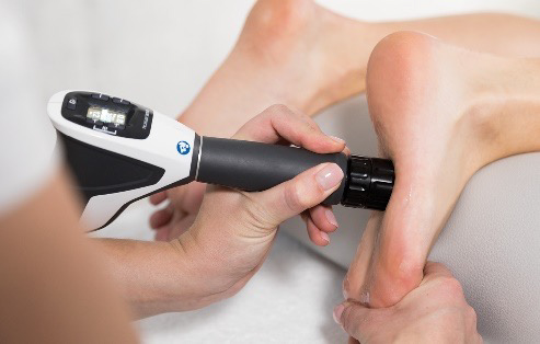 Shockwave Therapy in Clevedon